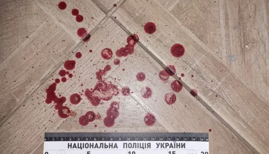 У Рівному поліцейські затримали чоловіка за ножове поранення сусіда
