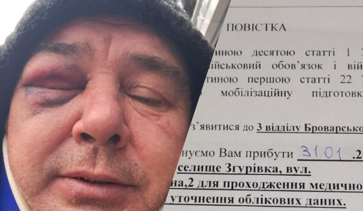 Ви зараз переглядаєте На Київщині новий скандал через ТЦК